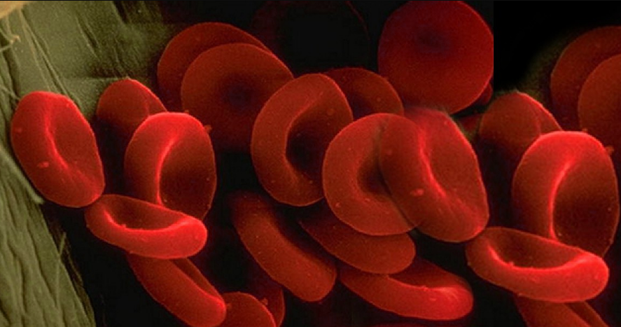 Эритроциты при анемии у пожилых